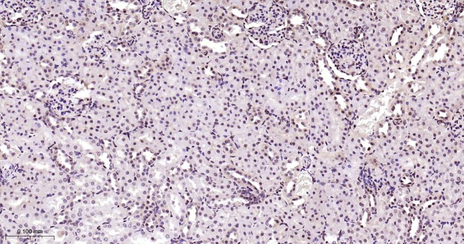 磷酸化雷帕霉素靶蛋白重组兔单抗