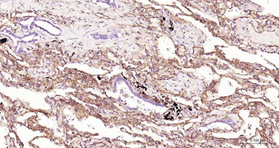 细胞间粘附分子-1（CD54）抗体-bs-0608R