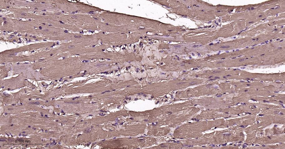 肌红蛋白重组兔单抗