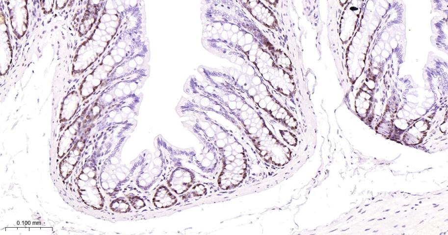 增殖细胞核抗原（内参）重组兔单抗