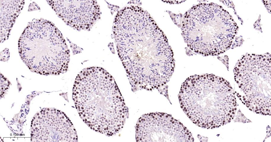 增殖细胞核抗原（内参）重组兔单抗