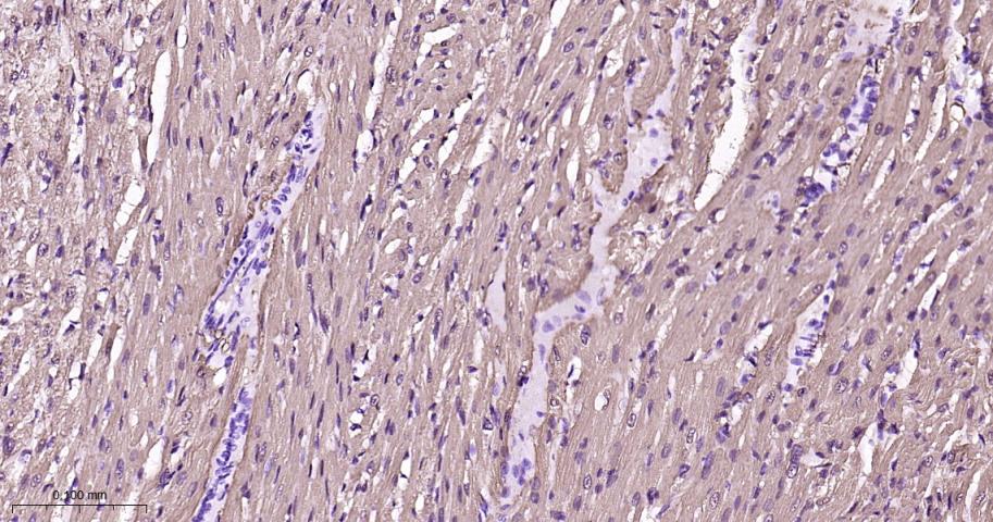 肌红蛋白重组兔单抗