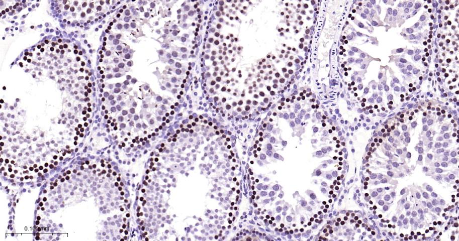 增殖细胞核抗原（内参）重组兔单抗