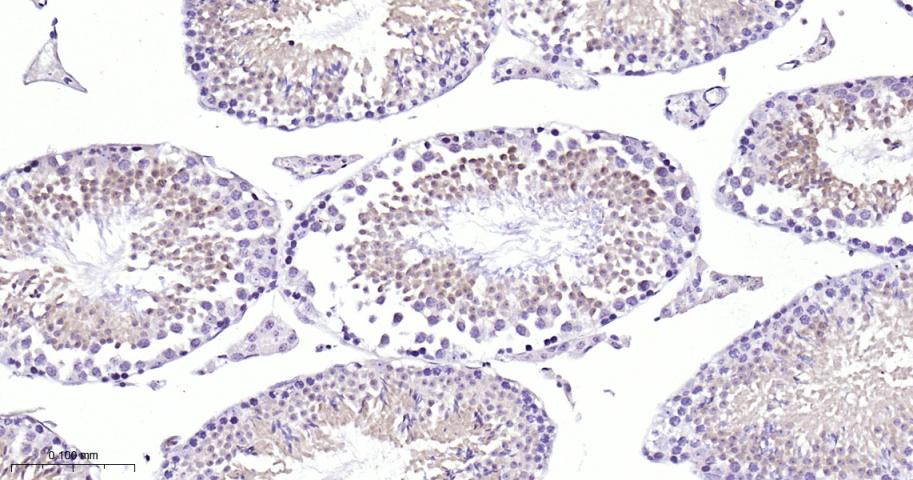 蛋白激酶C重组兔单抗