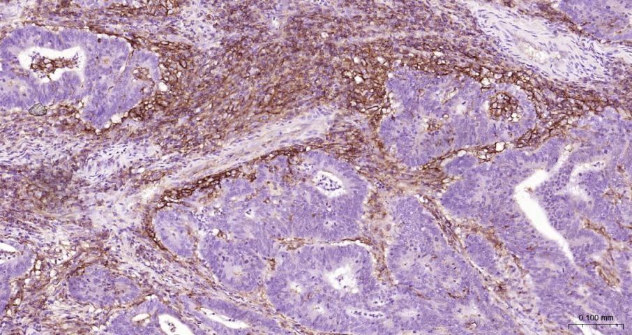 细胞间粘附分子-1（CD54）抗体-bs-0608R