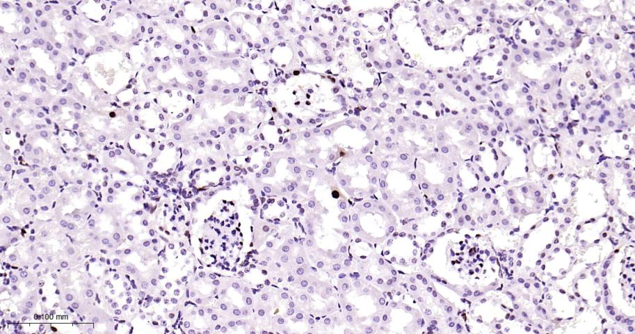 增殖细胞核抗原（内参）重组兔单抗