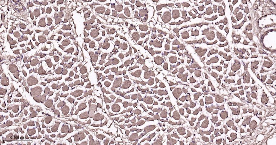 肌红蛋白重组兔单抗