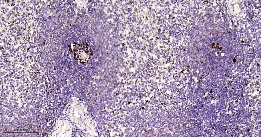 增殖细胞核抗原（内参）重组兔单抗