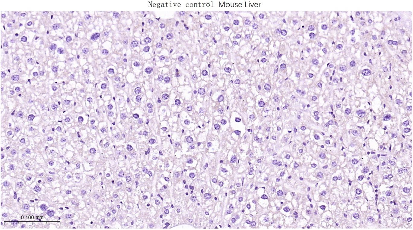 肌红蛋白重组兔单抗