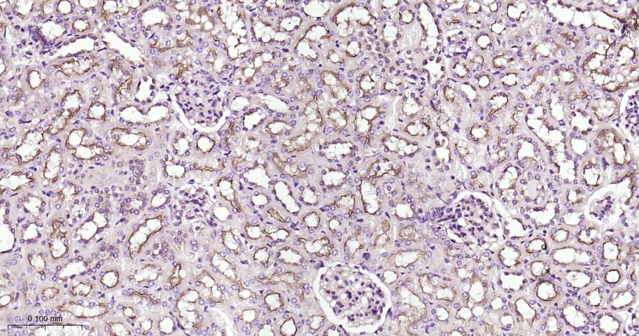 网格蛋白重链重组兔单抗-bsm-61487R
