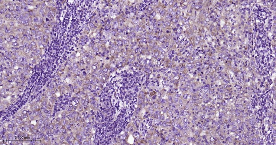 网格蛋白重链重组兔单抗-bsm-61487R