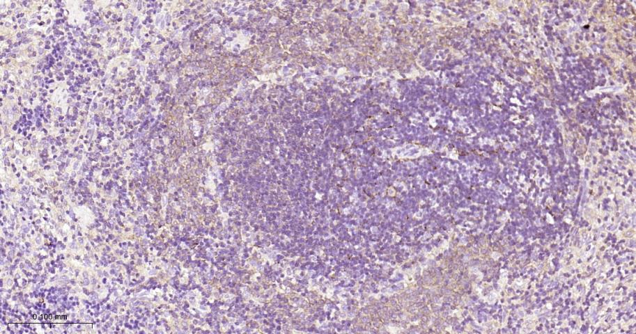 蛋白激酶C重组兔单抗