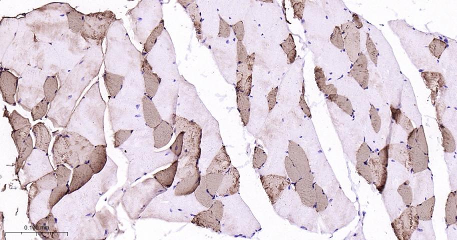 肌红蛋白重组兔单抗