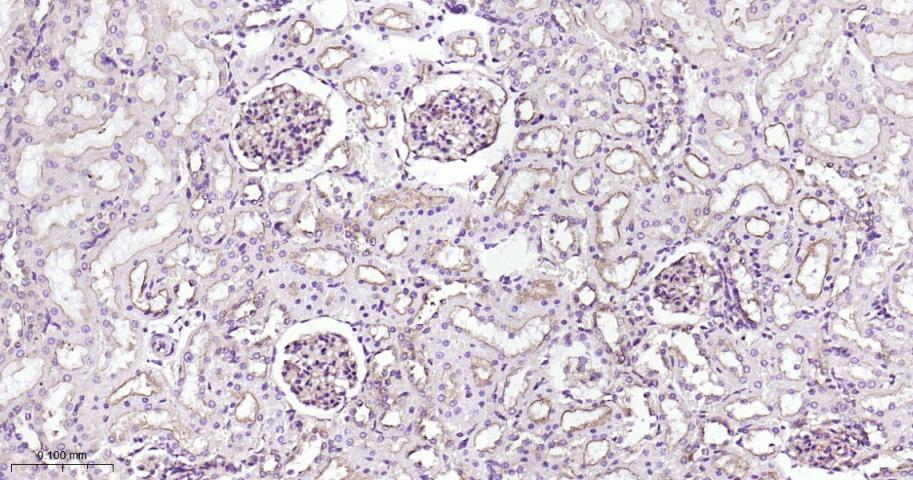 网格蛋白重链重组兔单抗-bsm-61487R