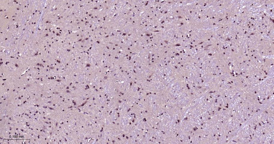 磷酸化雷帕霉素靶蛋白重组兔单抗