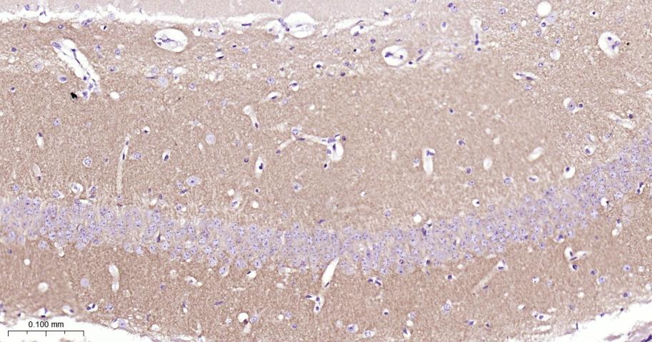蛋白激酶C重组兔单抗