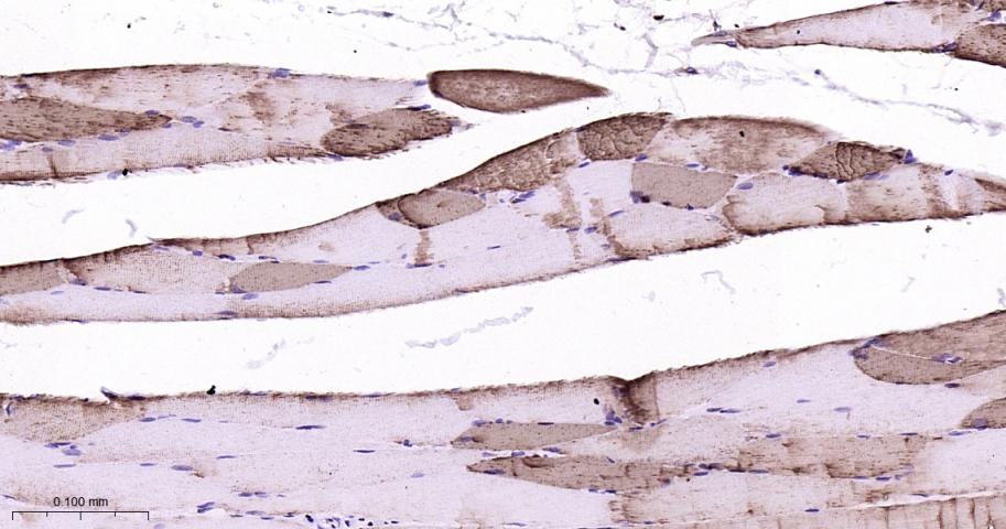肌红蛋白重组兔单抗