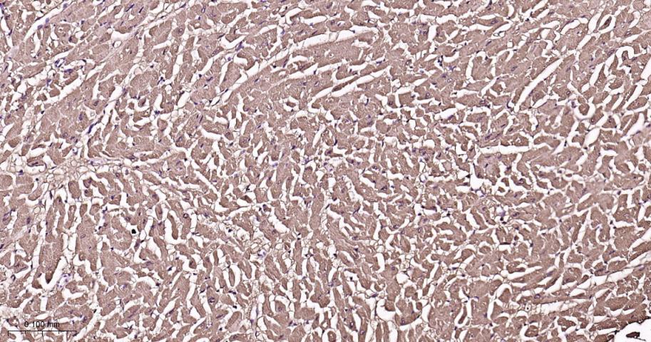 肌红蛋白重组兔单抗