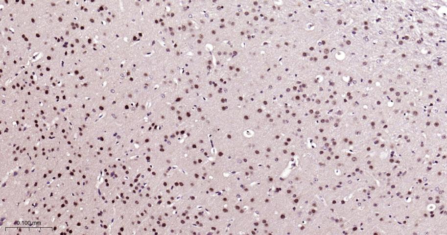 磷酸化雷帕霉素靶蛋白重组兔单抗