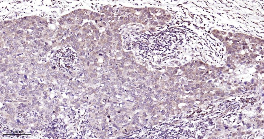 磷酸化雷帕霉素靶蛋白重组兔单抗