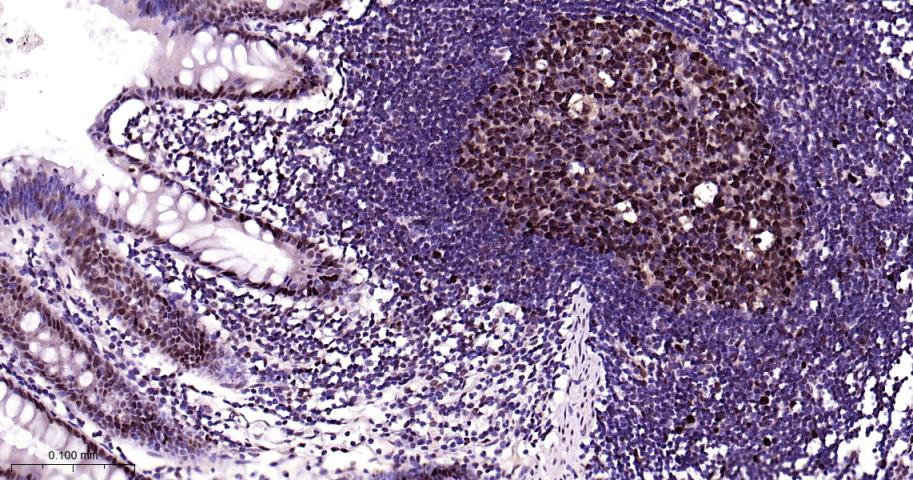 增殖细胞核抗原（内参）重组兔单抗