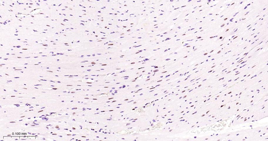 增殖细胞核抗原（内参）重组兔单抗