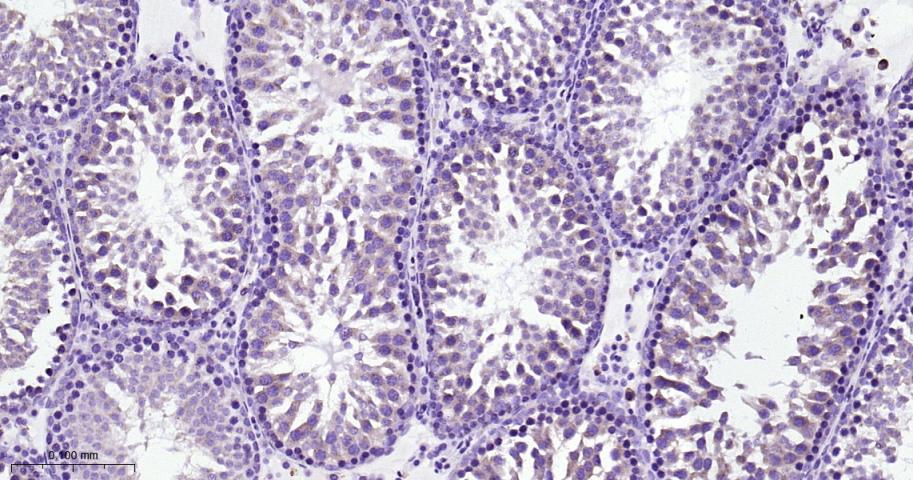 网格蛋白重链重组兔单抗-bsm-61487R