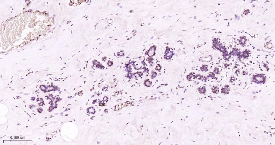 磷酸化信号转导和转录激活因子5a重组兔单抗