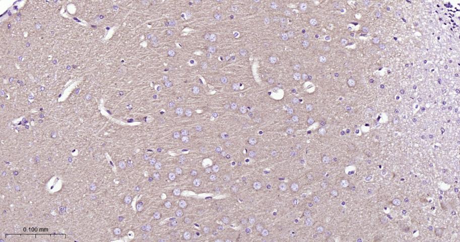 网格蛋白重链重组兔单抗-bsm-61487R