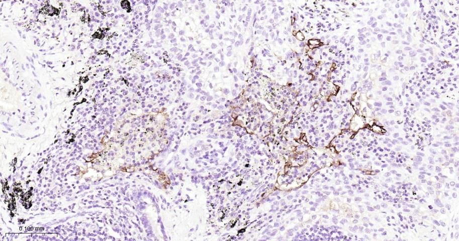 ICAM1/CD54 Mouse mAb (一抗) - IHC-P,IHC-F,IF | Bioss