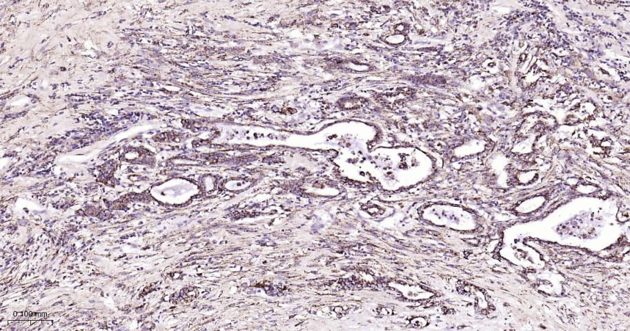 细胞信号转导分子SMAD3重组兔单抗