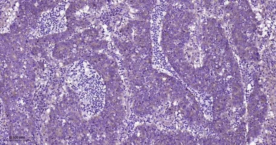 网格蛋白重链重组兔单抗-bsm-61487R
