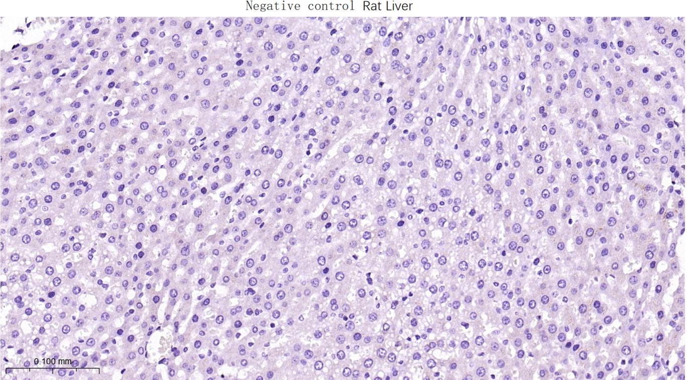 肌红蛋白重组兔单抗