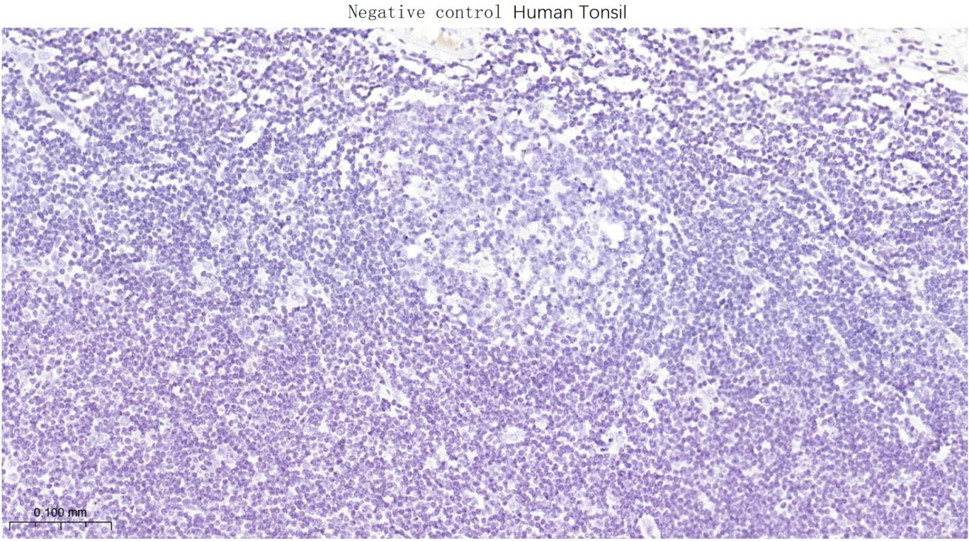 甲状腺核转录因子-1重组兔单抗