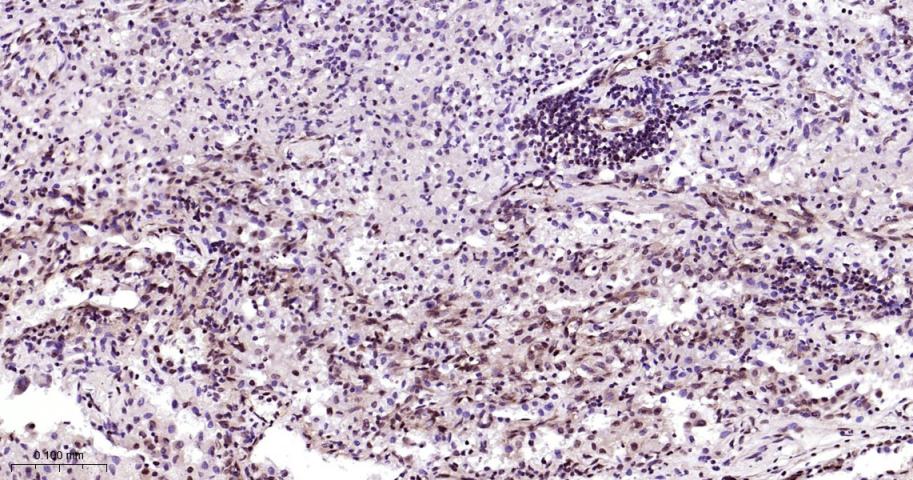磷酸化雷帕霉素靶蛋白重组兔单抗