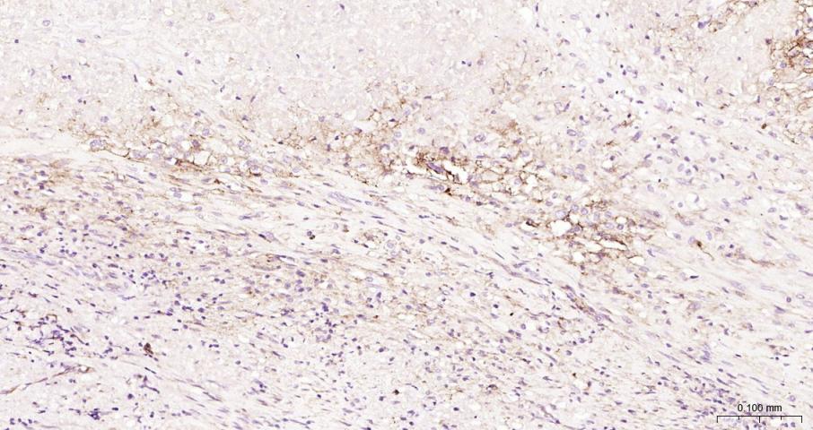 细胞间粘附分子-1（CD54）抗体-bs-0608R