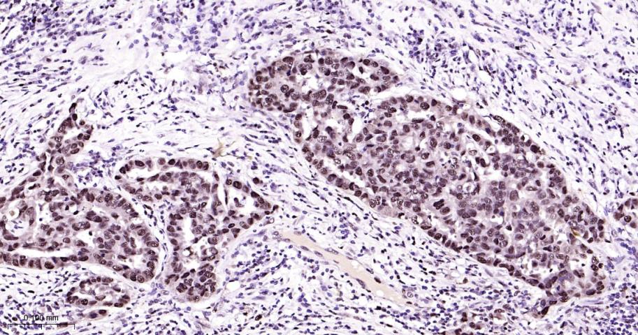 增殖细胞核抗原（内参）重组兔单抗