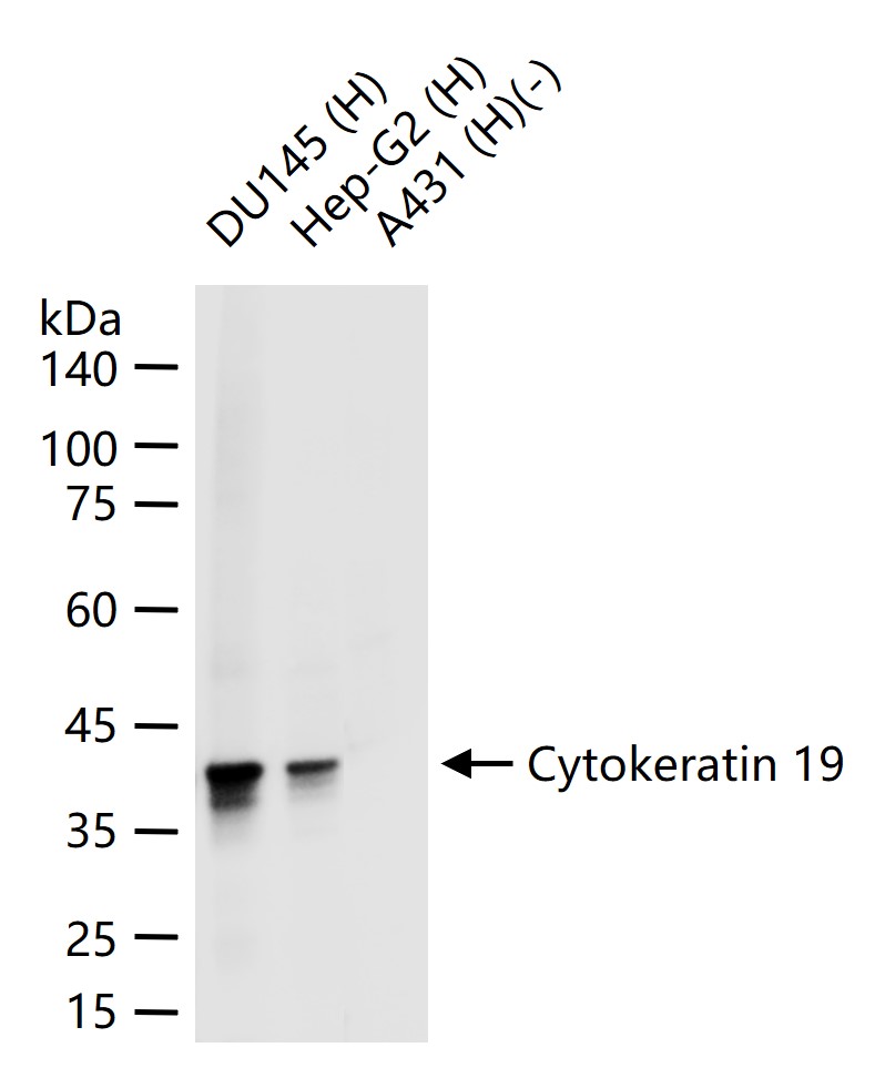 细胞角蛋白19重组兔单抗