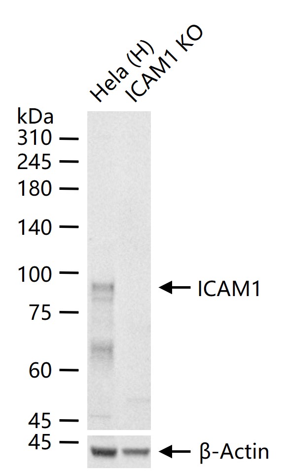ICAM1 Rabbit pAb (一抗) - WB,IHC-P,IHC-F,IF | Bioss