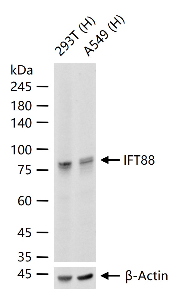 IFT88重组兔单抗