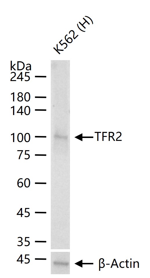 转铁蛋白受体2重组兔单抗