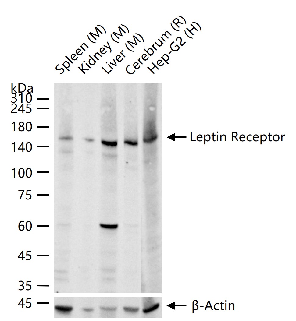 瘦素受体重组兔单抗