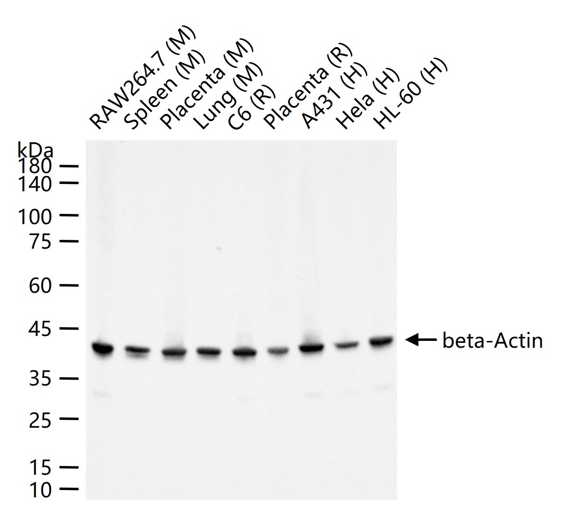 β-肌动蛋白（内参抗体）重组兔单抗