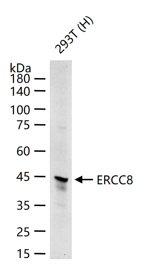 ERCC8 Recombinant Rabbit mAb (一抗) - WB,IP | Bioss