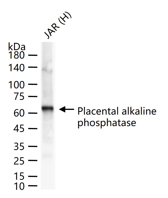 Placental alkaline phosphatase (PLAP) Recombinant Rabbit mAb (一抗) - WB,IHC-P,IHC-F,IF,ICC/IF | Bioss