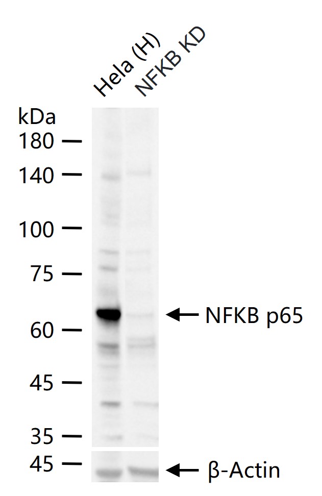 细胞核因子/k基因结合核因子抗体-bs-20160R