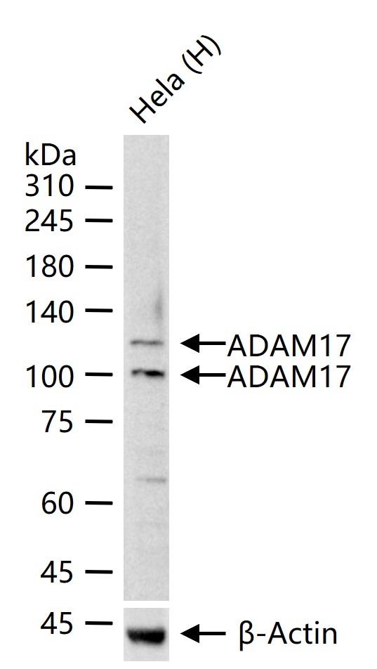 ADAM17 Rabbit pAb (一抗) - WB,IHC-P,IHC-F,IF,Flow-Cyt,ICC/IF | Bioss
