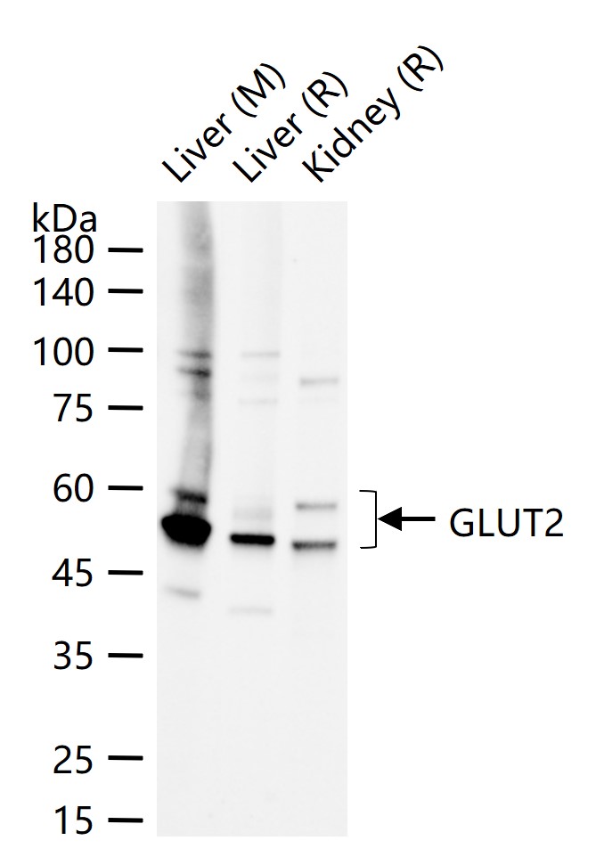 葡萄糖转运蛋白2重组兔单抗