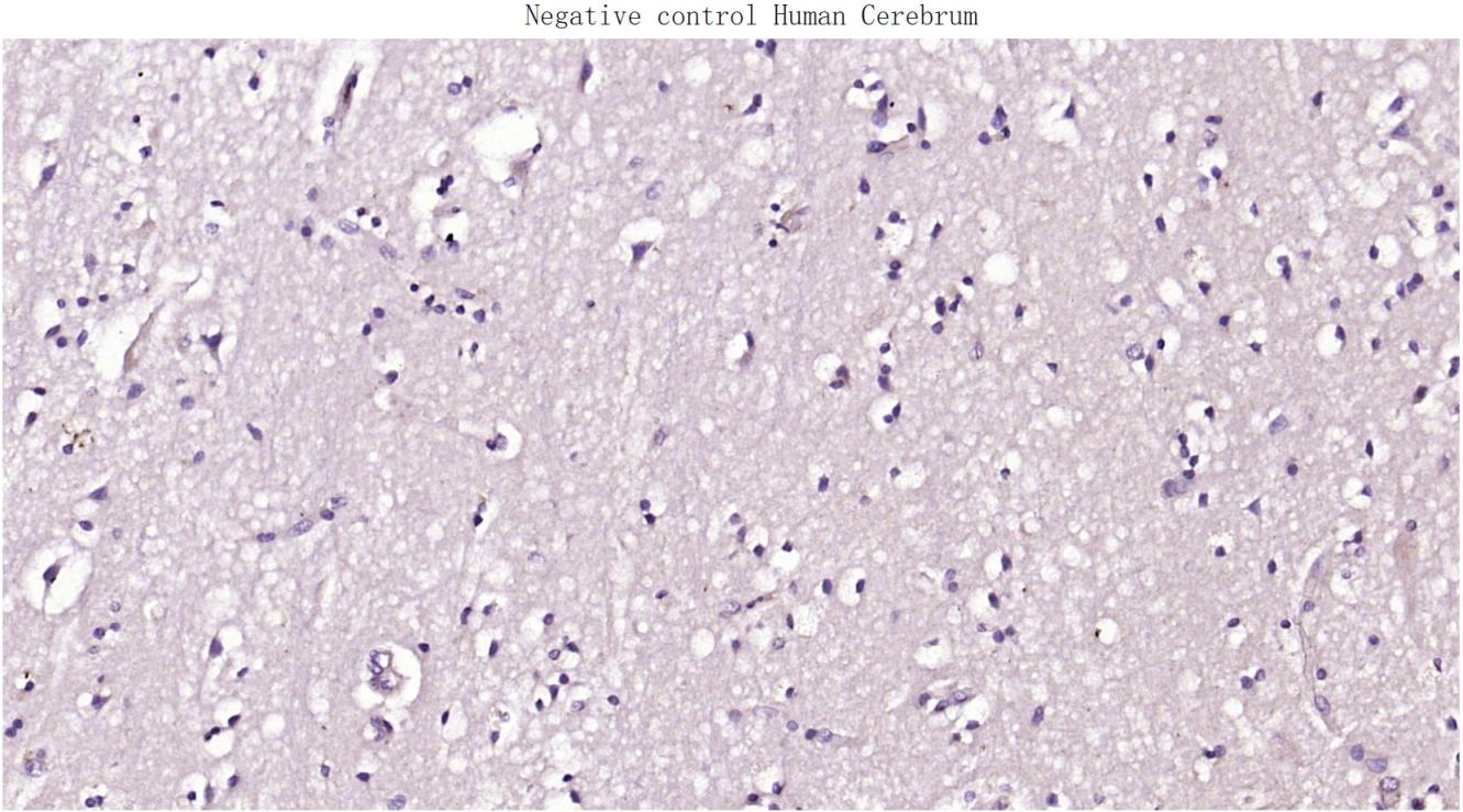 心肌肌钙蛋白重组兔单抗-bsm-52818R