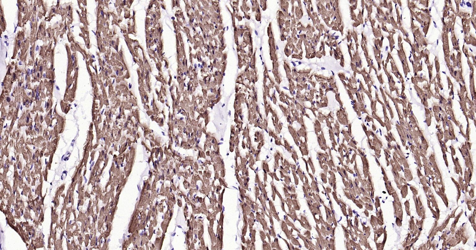 Cardiac Troponin I/TNNC1 Recombinant Rabbit mAb (一抗) - IHC-P,IHC-F,IF,ICC/IF,IP | Bioss
